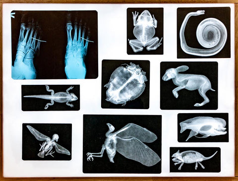 X-ray images on light table