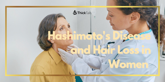 Hashimoto's Disease and Hair Loss