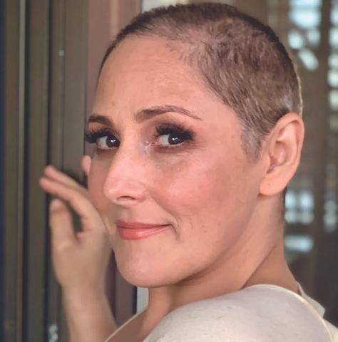 ricki lake hair loss