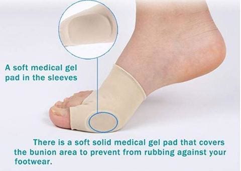 Orthopedic Bunion Corrector 60% OFF