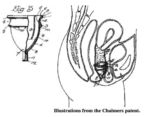 月経カップの開発の歴史