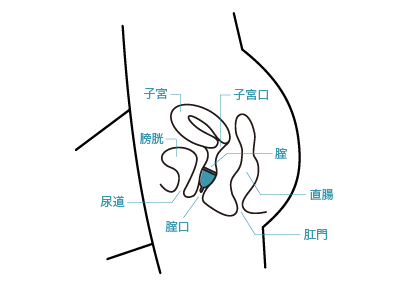女性の体と月経カップの装着位置
