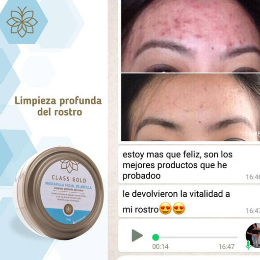  Class Gold Cosmetics Tonico Aclarante Facial. Manchas e  Imperfecciones. Clarifying Facial Tonic, Dark Spot and Blemish Remover from  Aqua Labs Colombia : Beauty & Personal Care