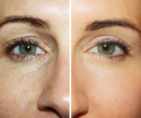 Colorescience TotalEye 3-in-1Renewal Therapy SPF35 before and after