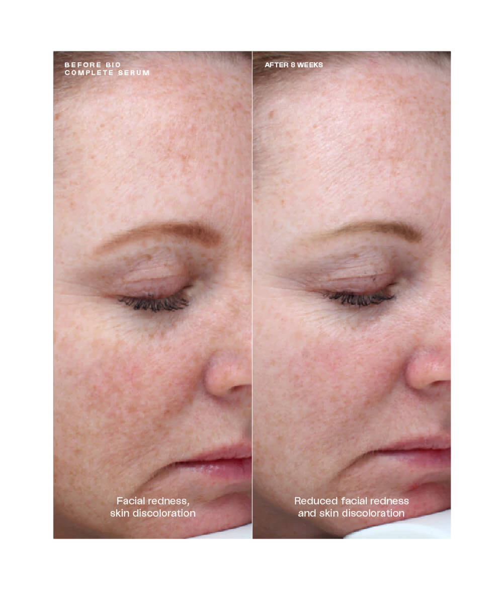 sente bio complete serum before and after