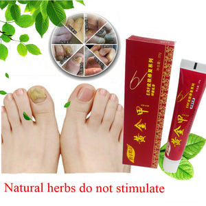 Thumbnail Infection Treatment chinese medicine plaster nail treatment cream onychomycosis anti fungal nail infection fights bacteria naturally ointment