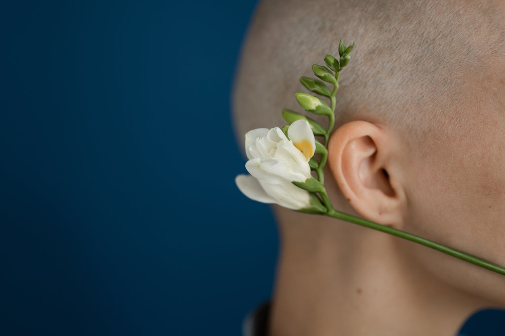 Image of woman with hair loss due to cancer with flower by ear