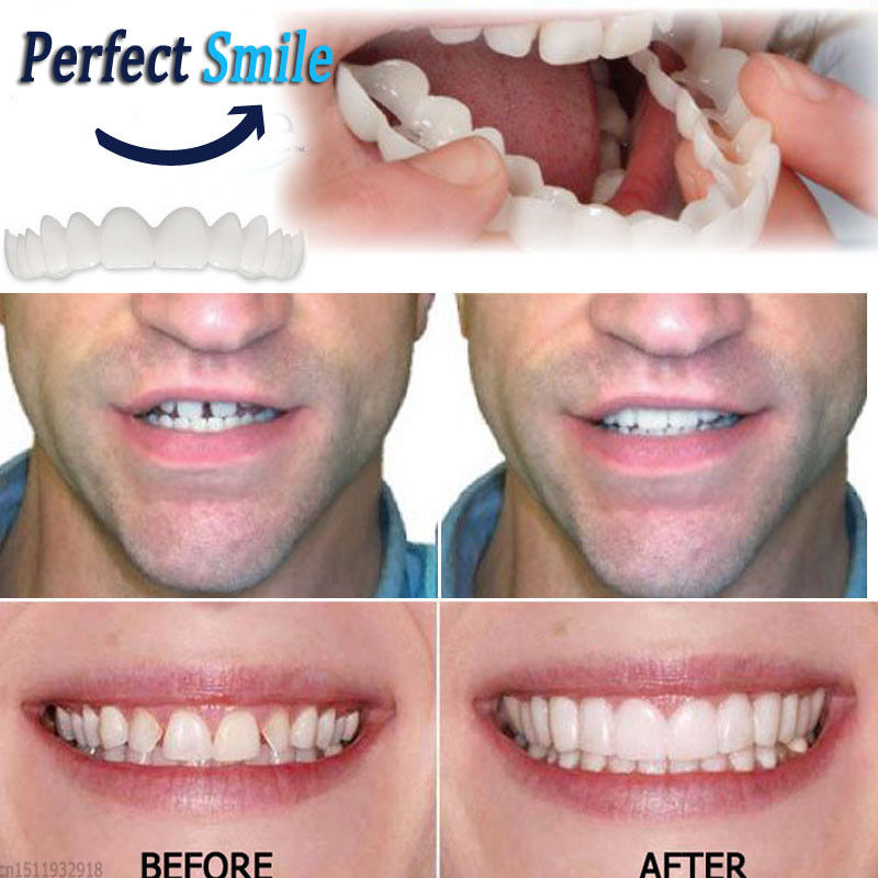 The Original Clip On Smile Instant Smile Veneer - Outletizer