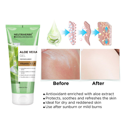 aloe vera pour la peau