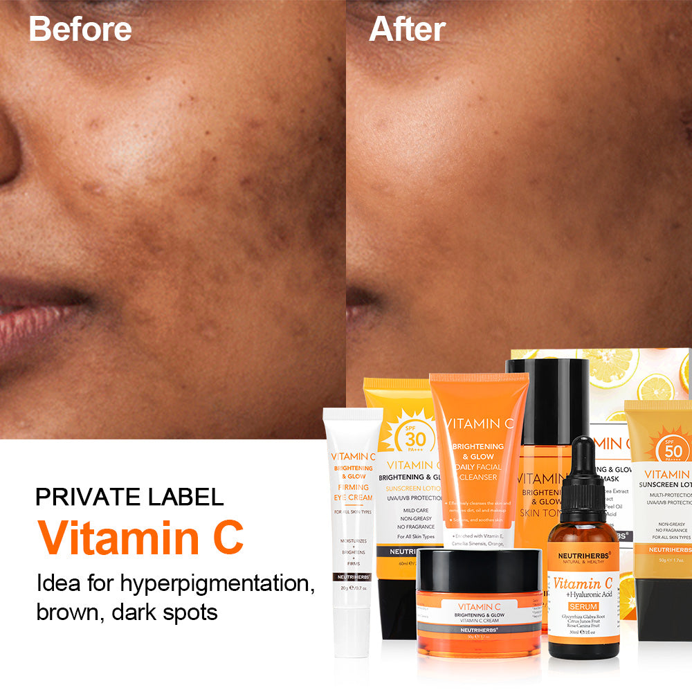 PRIVATE LABEL Vitamin C Skincare Product idea for Hyperpigmentation, brown, dark spots. 