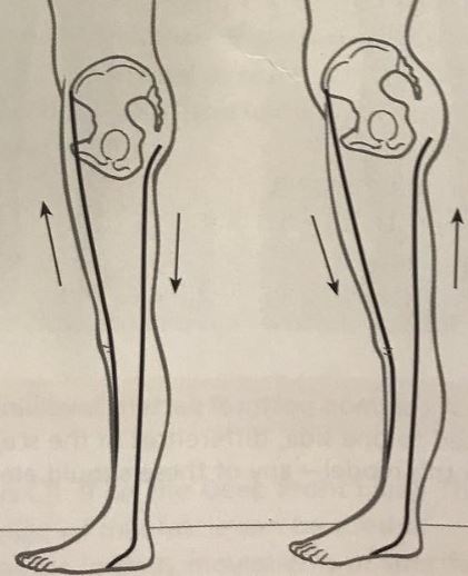 heel-effect-on-hip