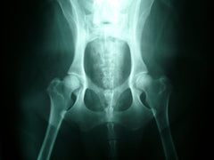 Hip dysplasia supplement