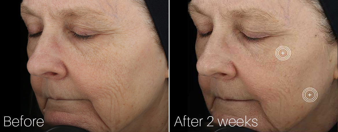 SkinMedica TNS Advanced+ Serum Before and After 2 weeks