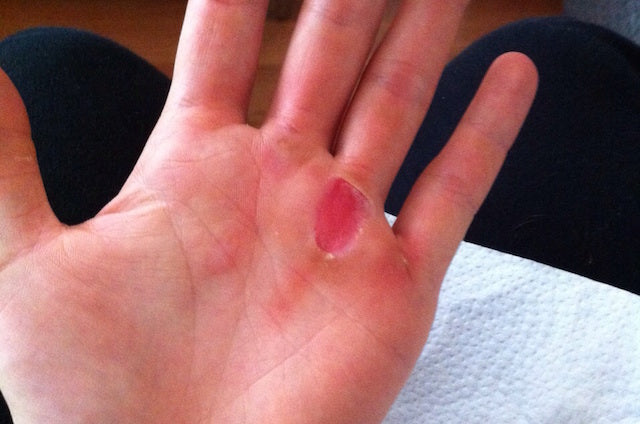 droom Nieuwsgierigheid Zegenen Hand Tears Around the World: Product review by a CrossFit Open athlete –  RIPT Skin Systems