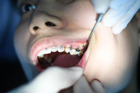 Teeth Being checked