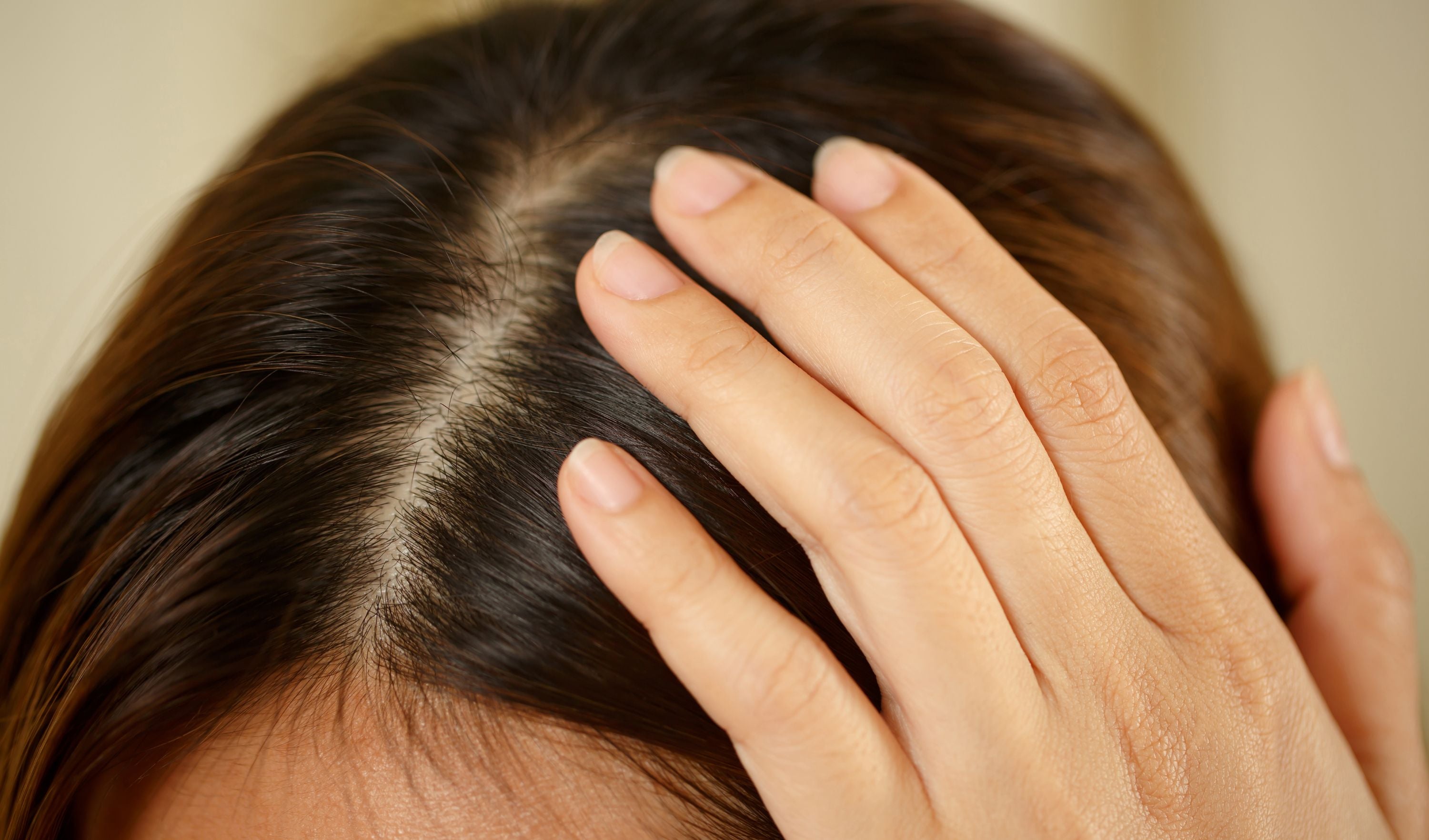 Cette huile essentielle favorise la pousse de cheveux, selon les  dermatologues