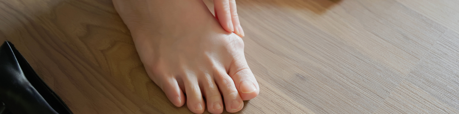 hallux valgus