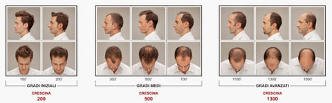 Crescina classification man thinning hair to read on Beaute.ae