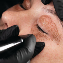 Fibroblast Pen Treatments for the Face, Neck and Décolleté