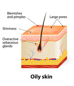 Chart for skin-type