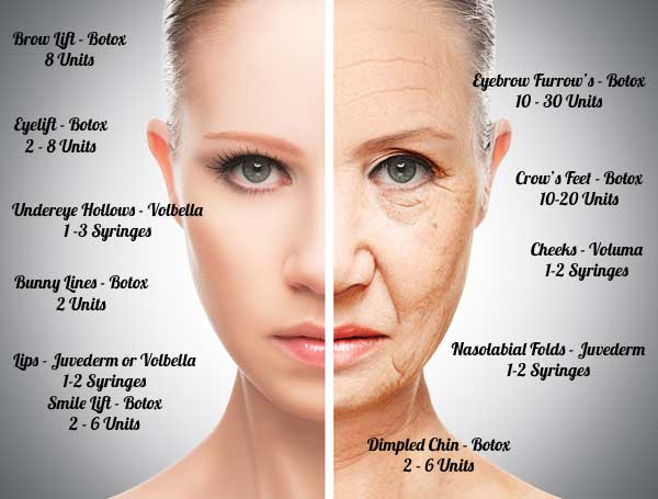 Wrinkle Fillers and Botox Treatments