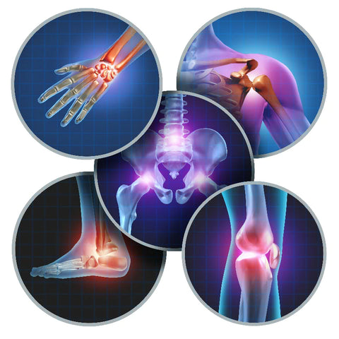 Arthritis joints