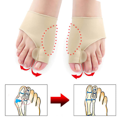 bunion-correction