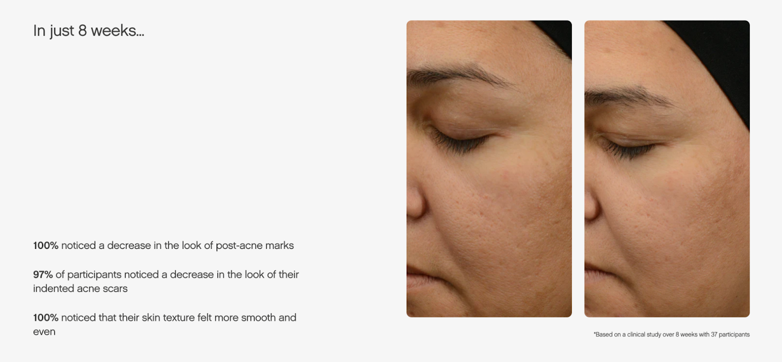 The webpage for Topicals' active scar primer shows before-and-after imagery, highlighting the product's effectiveness.