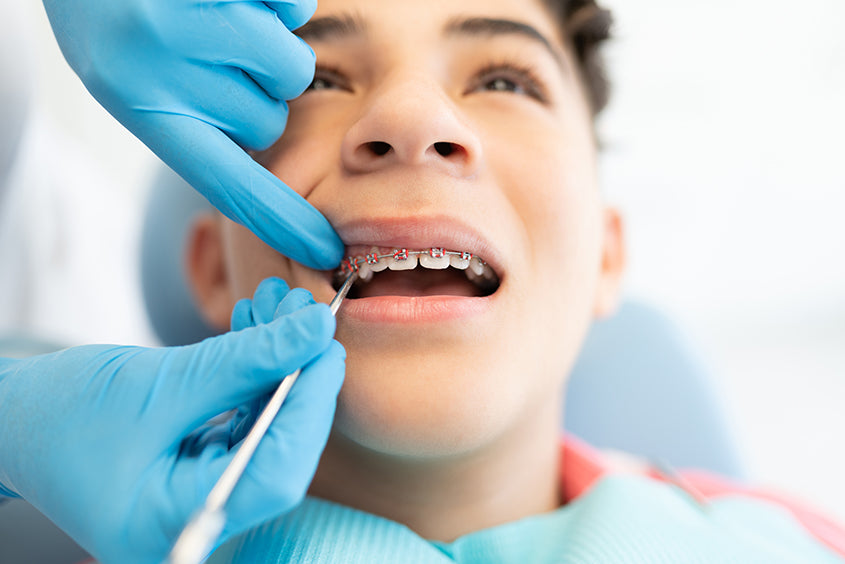 a boy with braces getting his teeth cleaned at the dentist