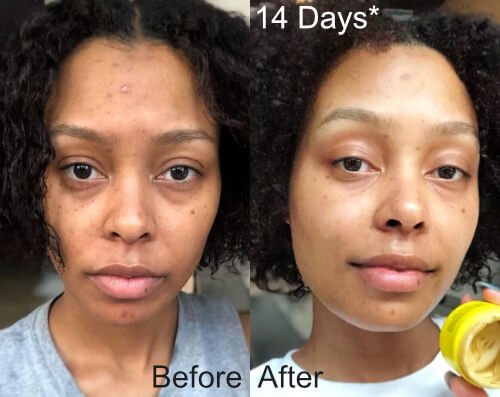 Turmeric mask before and after pictures