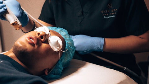 A man getting Laser Facial Genesis from Skin Spa to get rid of smile lines