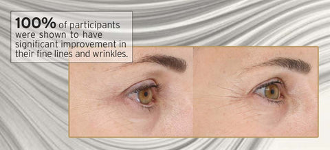 100% of participants were shown to have significant improvement in their fine lines and wrinkles.
