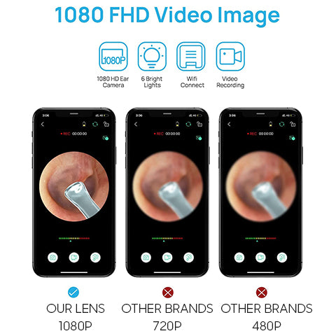 1080P HD Lens