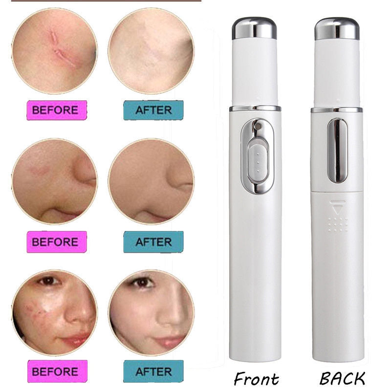 Beauty Instrument Blue Light Therapy Laser Pointer Remove Acne Scars  Anti-Wrinkle Face Treatmen...