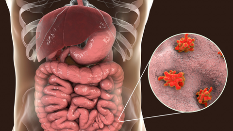 entamoeba coli in gut