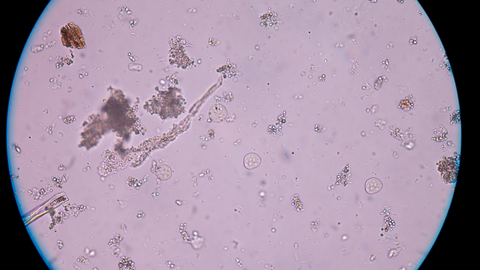 protozoa