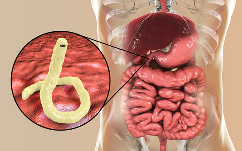 hookworm infection