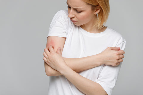 Woman experiencing a rash on her arm from detoxing