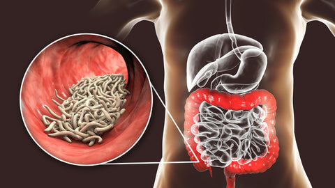 ascaris lumbricoides infection