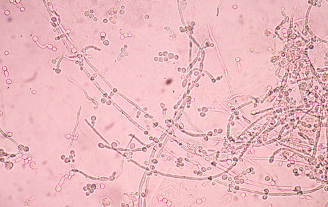 Yeast infection under microscope