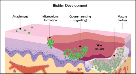 Biofilm formation in humans