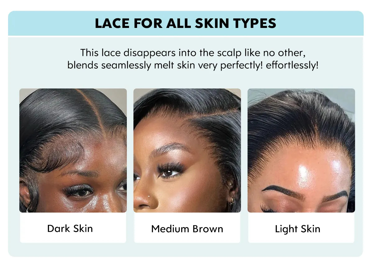 lace for all skin