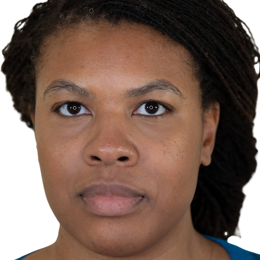 Close-up of a person with short hair, looking slightly upward.