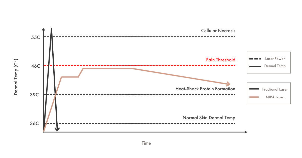 Line graph demonstrating the science behind NIRA’s non-fractional, non-ablative laser technology