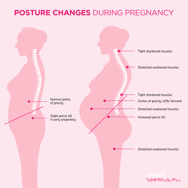 Posture changes during pregnancy
