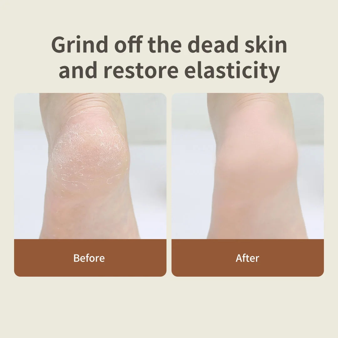 DOCO Electric Pedicure Foot Polishing Artifact to Remove Dead Skin Rub Calluses Beauty foot Grinding Stone Knife Home Foot Care - Image 3