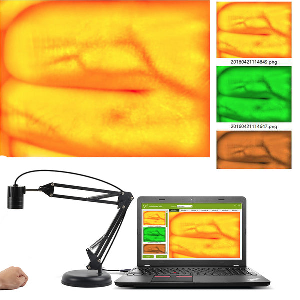 YOSOO Vein Locator Localisateur de visionneuse de veine d