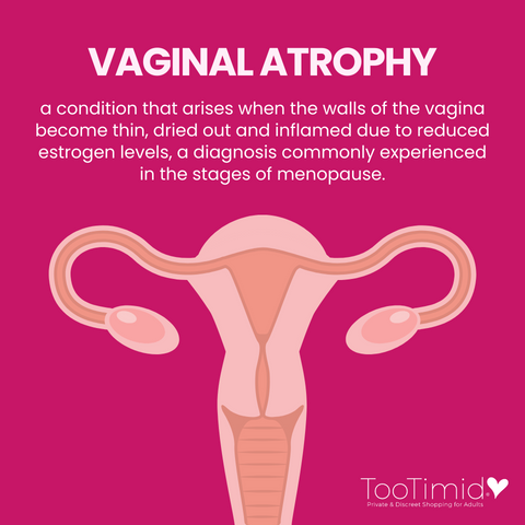 Vaginal Atrophy: a condition that arises when the walls of the vagina become thin, dried out and inflamed due to reduced estrogen levels, a diagnosis commonly experienced in the stages of menopause.