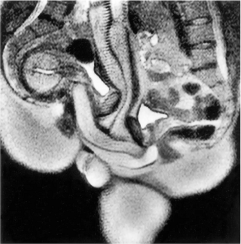 MRI scan showing what happens to our bodies during sex