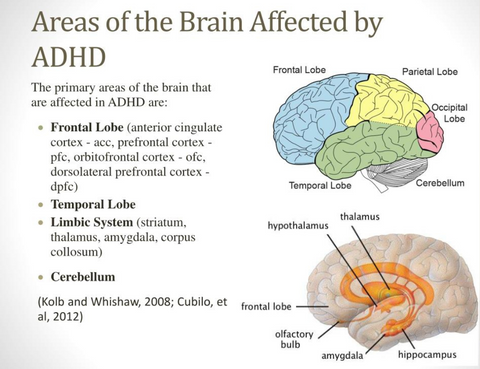Areas of the Brain Affected By ADHD